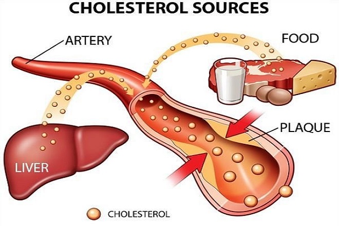 giảm cholesterol xấu