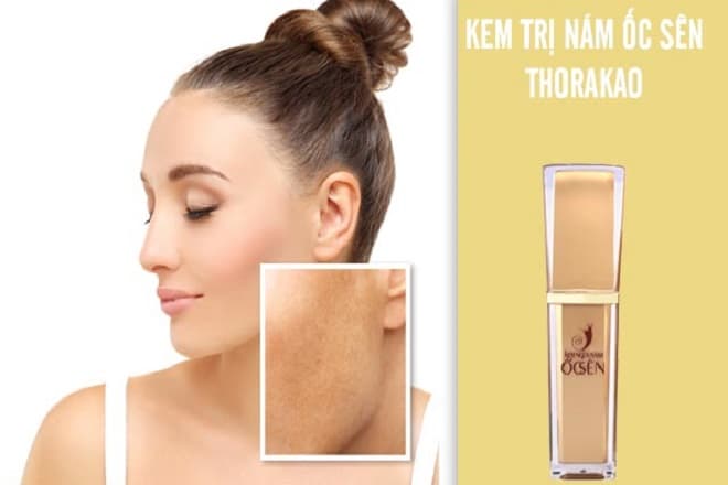 review kem ốc sên trị nám thorakao có tốt không