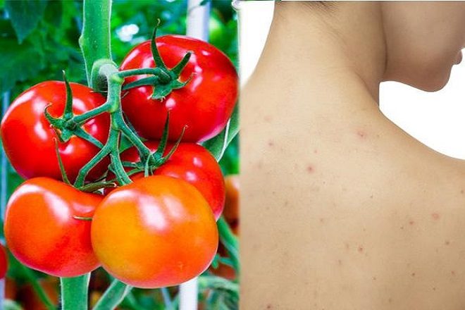 Cà chua chứa nhiều dưỡng chất giúp chăm sóc da