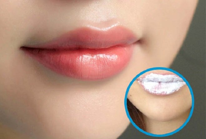 Cách trị thâm môi bằng kem đánh răng