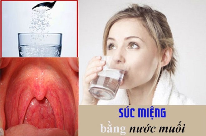 ngăn ngừa đau họng