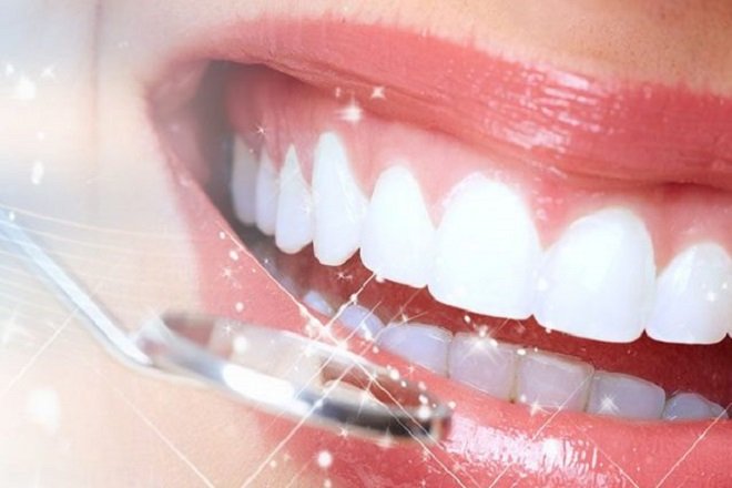 Cạo vôi răng không gây ảnh hưởng đến sức khỏe răng miệng