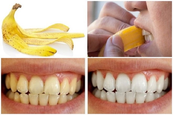 Bạn có thể làm trắng răng, loại bỏ bớt mảng bám bằng những phương pháp trong dân gian