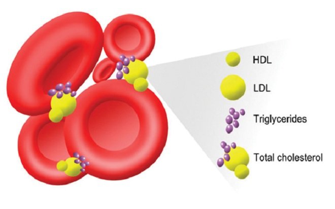 Giảm cholesterol trong máu