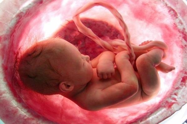 Sót nhau thai sau sinh có thể dẫn đến vô sinh, tử vong ở sản phụ