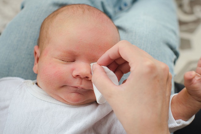 Bé sơ sinh bị nổi mẩn đỏ ở mặt – Mẹ phải làm sao?
