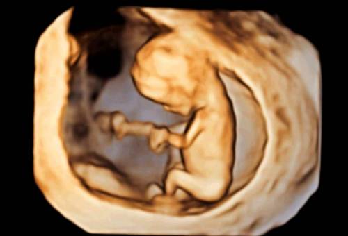 Hình ảnh thai nhi cùng với siêu âm 2D, 3D, 4D chính là cách tuyệt vời để kết nối bà mẹ với thai nhi. Việc quan sát được hình ảnh thai nhi trên máy siêu âm sẽ khiến cho tình mẫu tử trong gia đình bạn càng được củng cố hơn. Bấm ngay vào hình ảnh để thấy những khoảnh khắc đáng yêu của thai nhi bạn nhé.