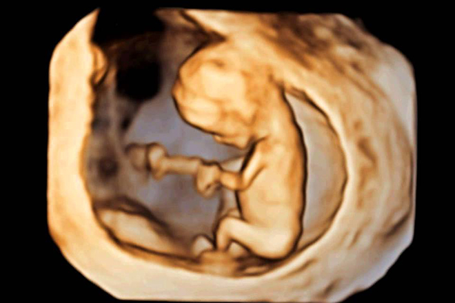 Mang thai là một quá trình kỳ diệu và đầy cảm xúc. Hãy chiêm ngưỡng những hình ảnh đẹp nhất của những thai nhi đang lớn lên bên trong cơ thể mẹ.