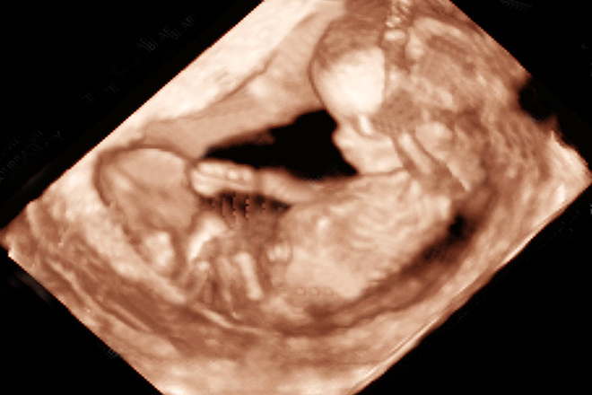 Hãy khám phá chuyến phiêu lưu với kỹ thuật siêu âm thai 4D, tìm hiểu mọi chi tiết về bé yêu trong bụng mẹ. Với khả năng tạo hình chân thực và sinh động, bạn sẽ như được chiêm ngưỡng một siêu sao nhỏ đã sẵn sàng để chào đời.