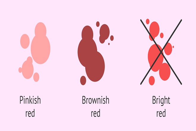 Máu báo thai có màu hồng nhạt hoặc nâu