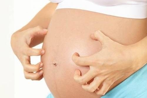 Ứ mật khi mang thai và những điều bà bầu mắc chứng này cần biết