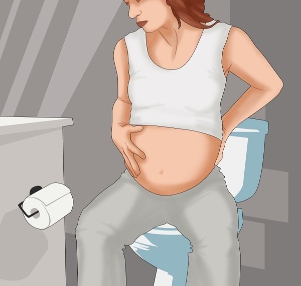 Nguyên nhân gây bệnh trĩ khi mang thai và cách phòng tránh để bệnh tiến triển nặng hơn